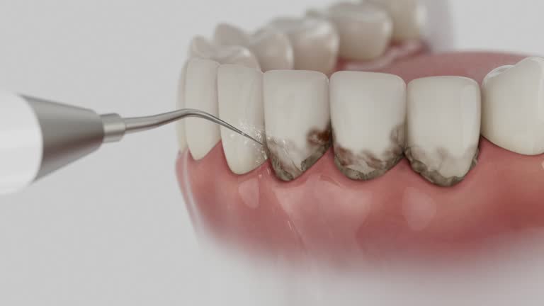 Trusted Dental Implants service in Walled Lake, MI - Dentist Open Now